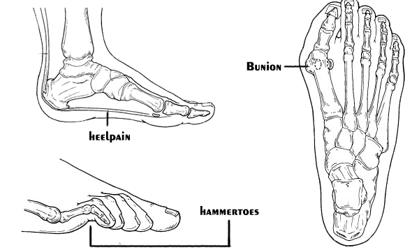 Infinity Foot and Ankle -